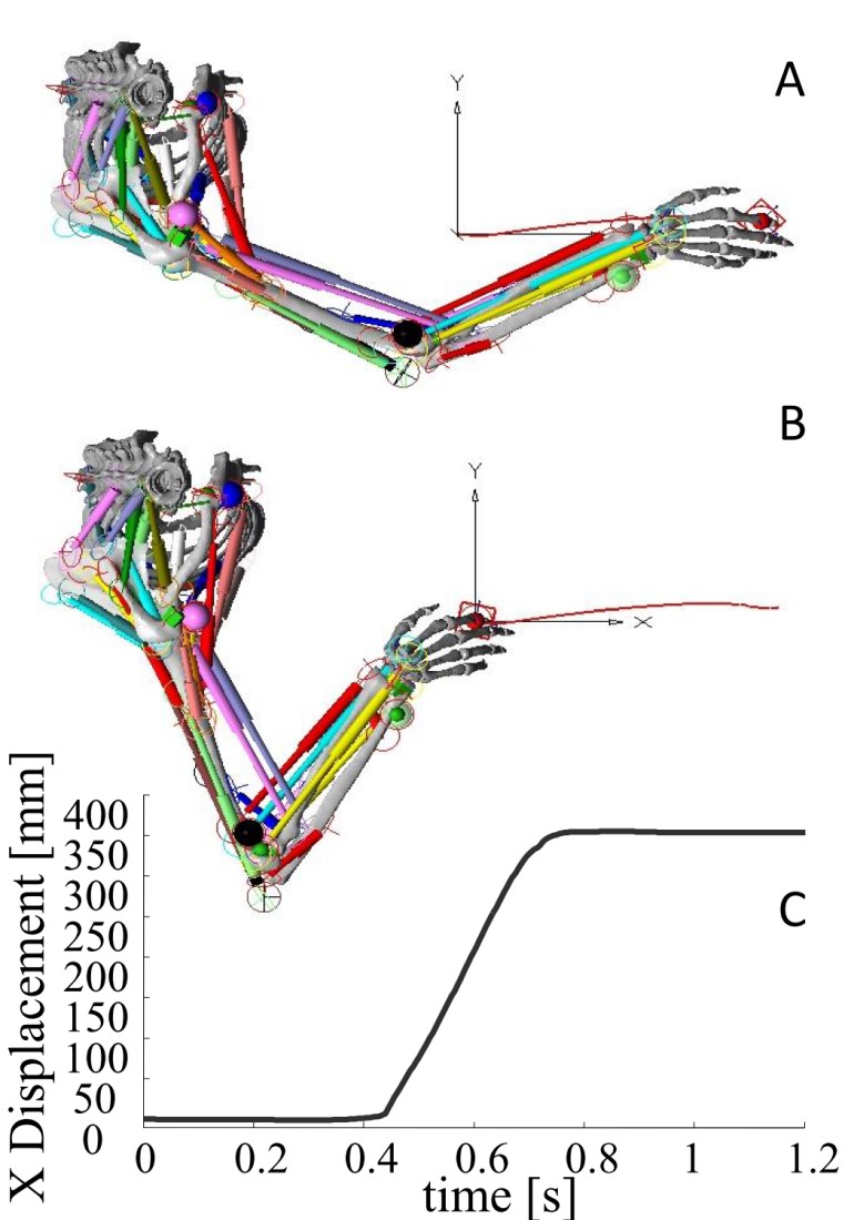 Muscle Stiffness